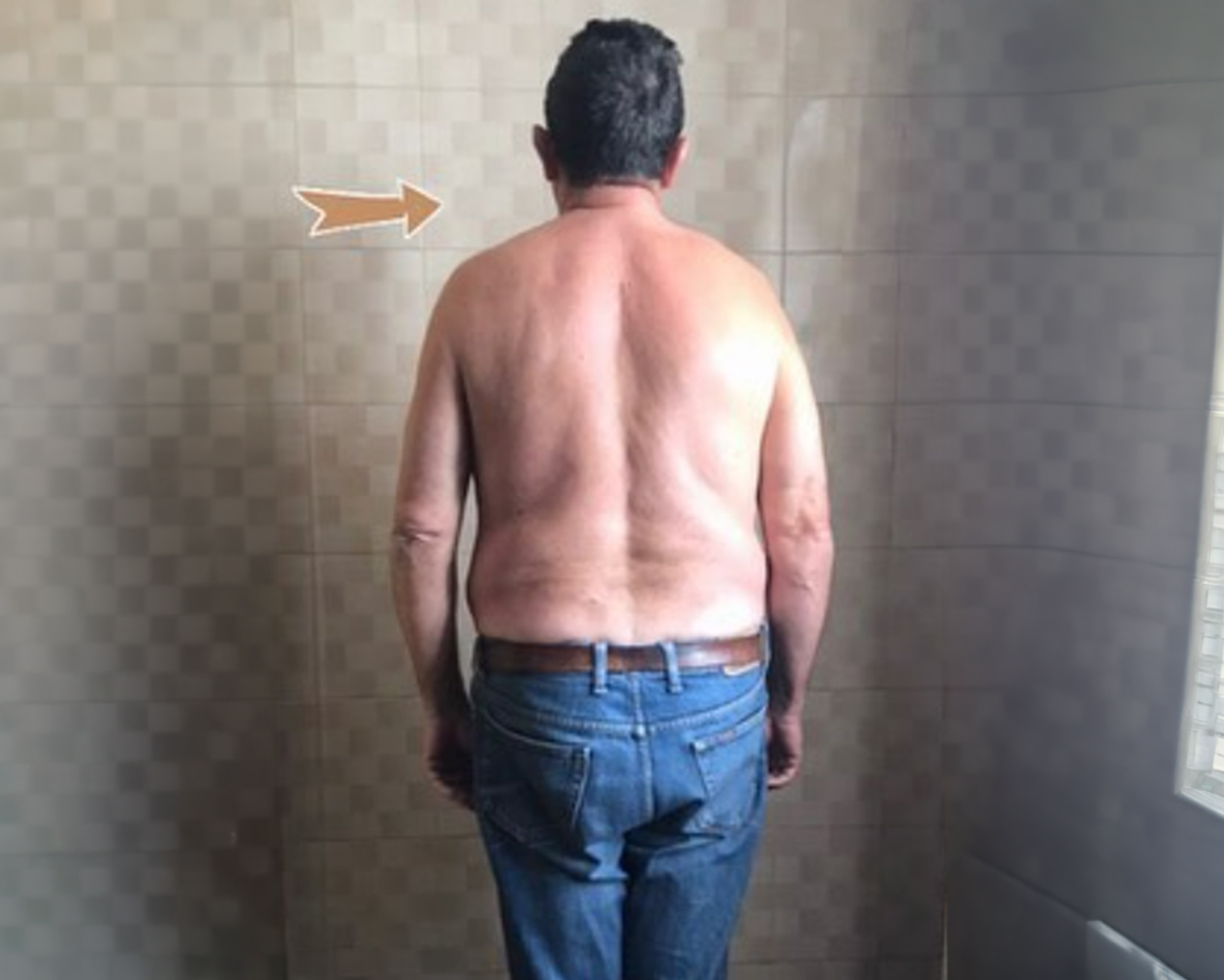 Dopo il trattamento - percorso 1