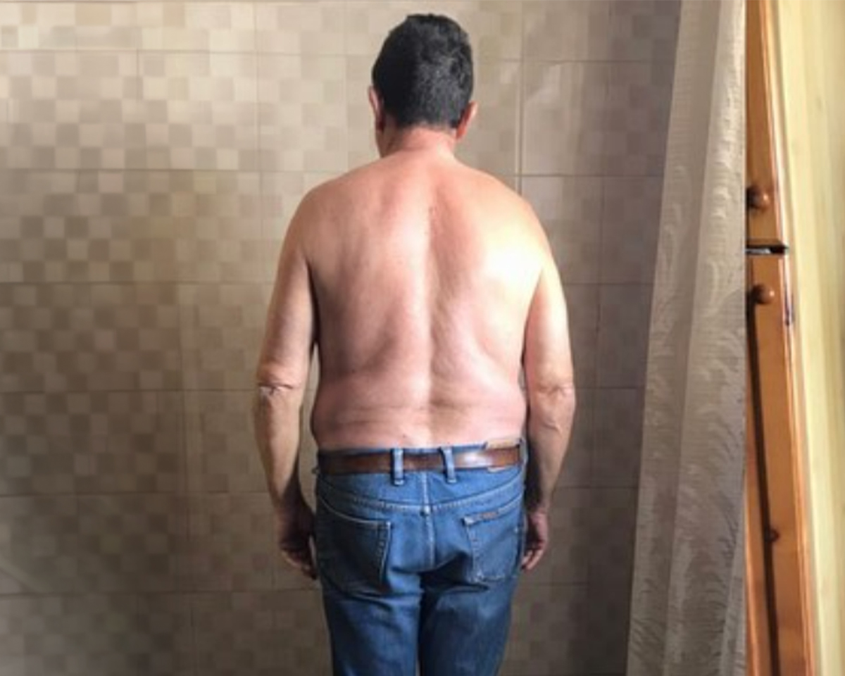 Prima del trattamento - percorso 1