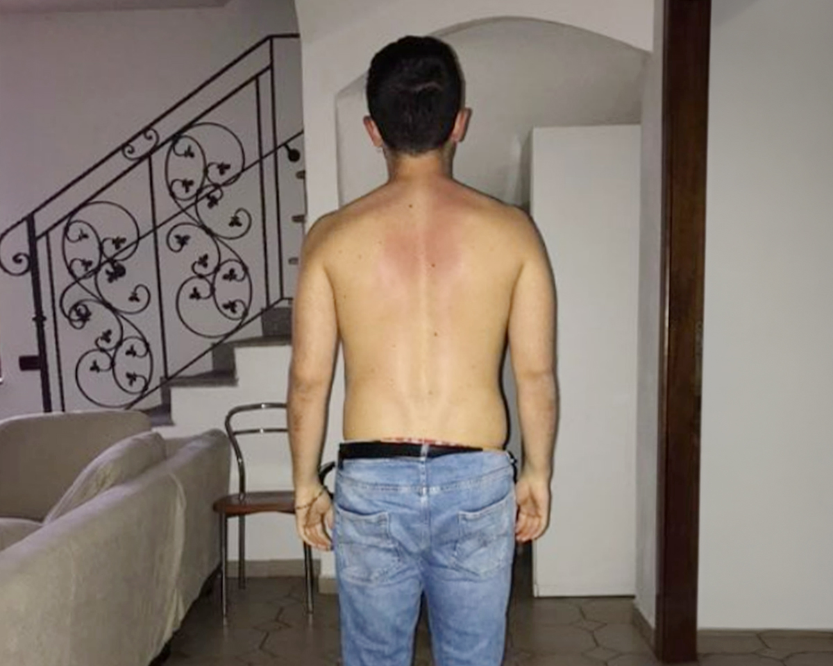 Dopo il trattamento - percorso 2