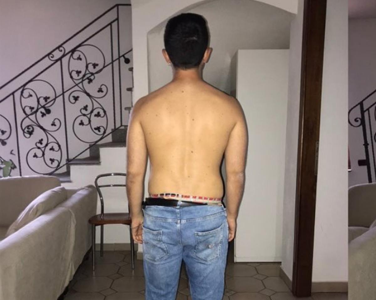 Prima del trattamento - percorso 2