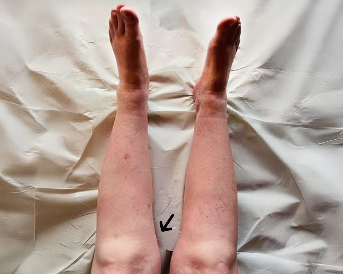 Dopo il trattamento - percorso 4